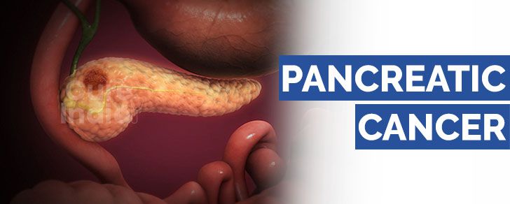 pancreatic cancer treatment in india